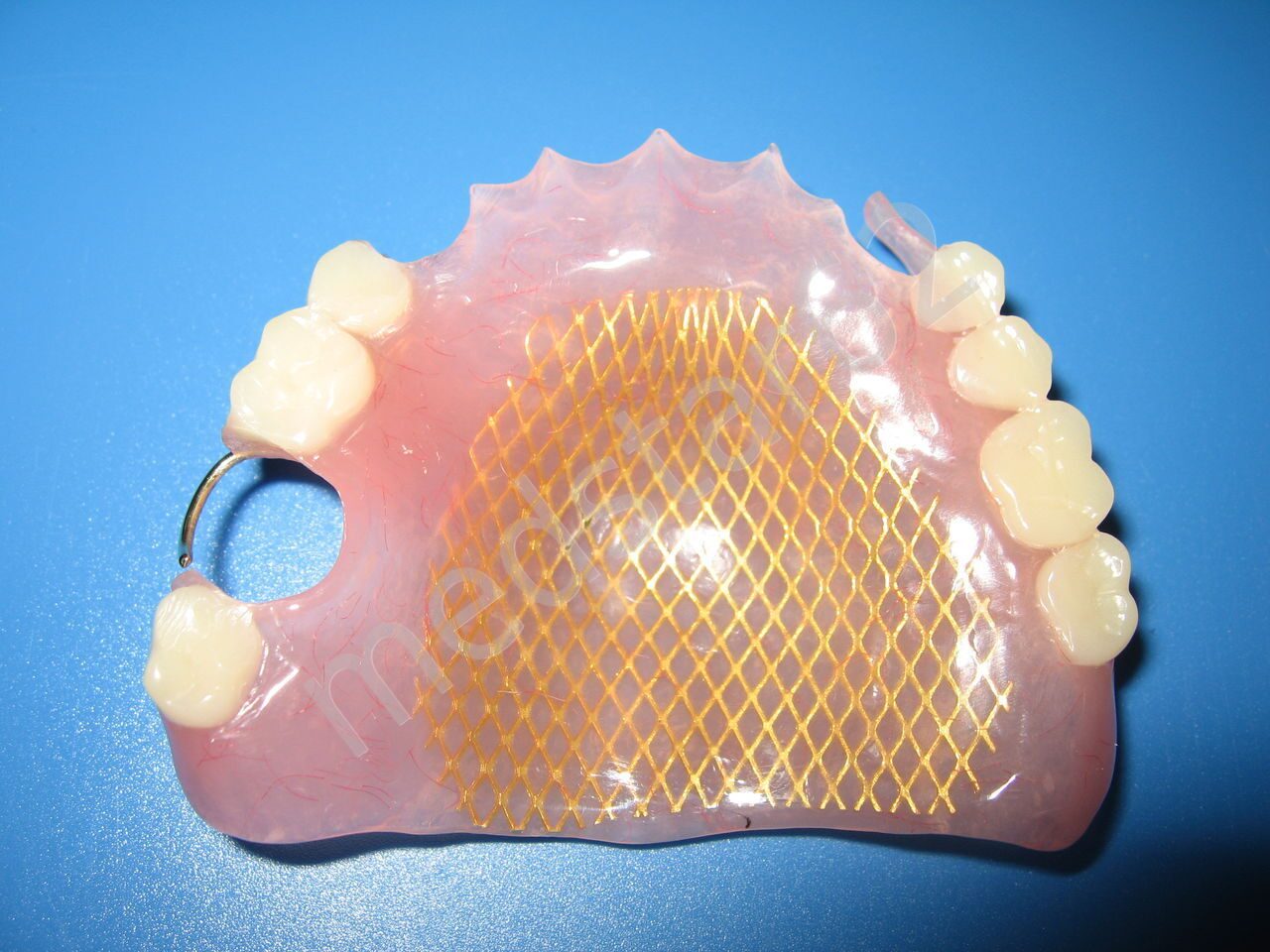 зубной протез 1